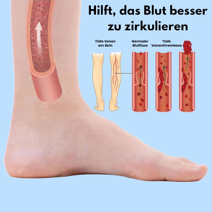 Letzter Tag 70% Rabatt | UpFeet™️ Schmerzfreie Beine in nur 15 Minuten!